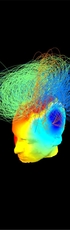 Spectral Signatures of Reorganised Brain Networks in Disorders of Consciousness